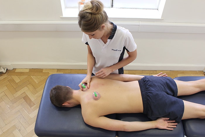 Cupping massage technique used on customers upper back in Manchester clinic
