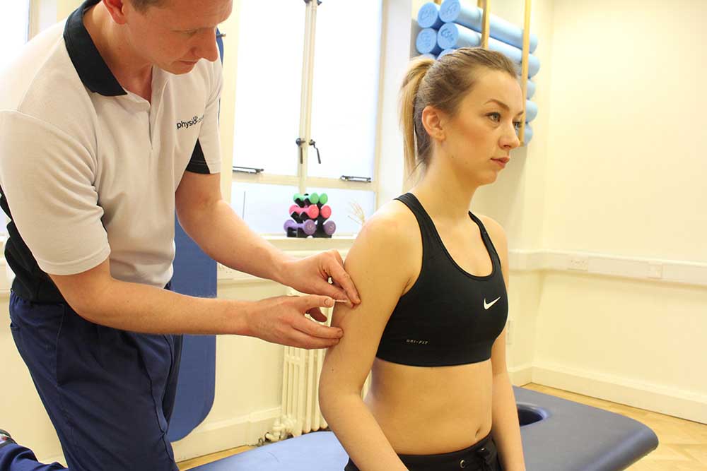 Specialist physiotherapist applying accupuncture to relieve symptoms of pain Specialist physiotherapist applying accupuncture to relieve symptoms of pain